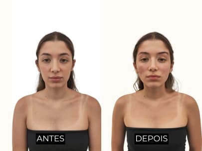 Resultado antes e depois 2