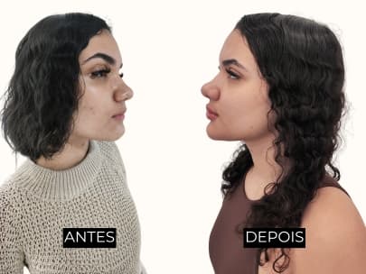 Resultado antes e depois 3