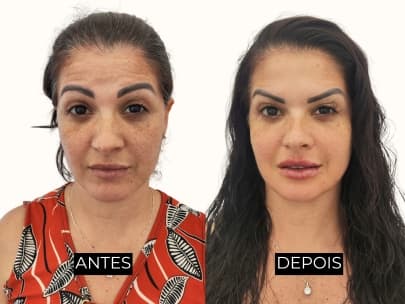 Resultado antes e depois 4